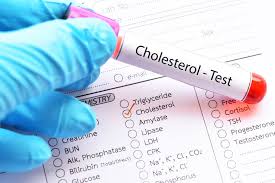 Oxidized Cholesterol (What it is & How to Lower it)